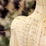 francis fournier acupuncture perpignan